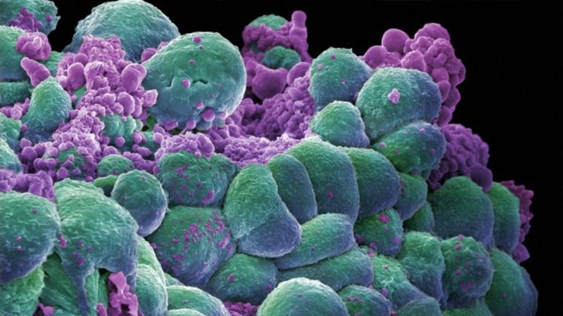 Cours 3 : Variations génétiques au sein de nos cellules et cancérisation
