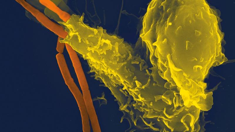 Cours 1 : La réaction inflammatoire, un mécanisme de l’immunité innée