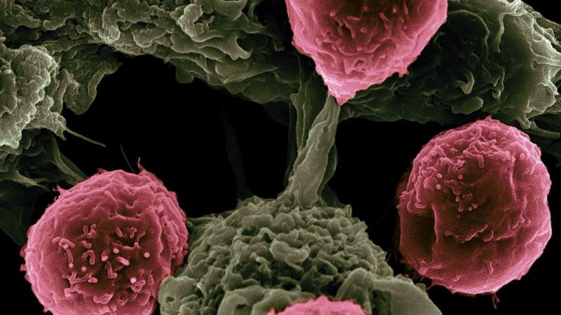 Cours 3 : Le fonctionnement du système immunitaire adaptatif