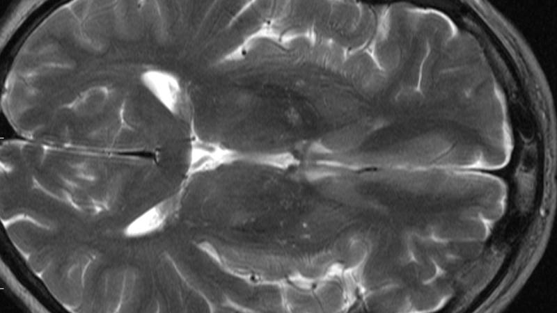 Cours 3 : Cerveau et mouvements volontaires